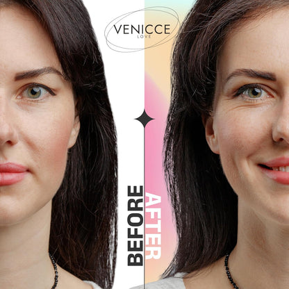 VENICCE LOVE™ Invisible Eyelid Lifting Bands